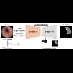 Automated segmentation of central airway obstruction